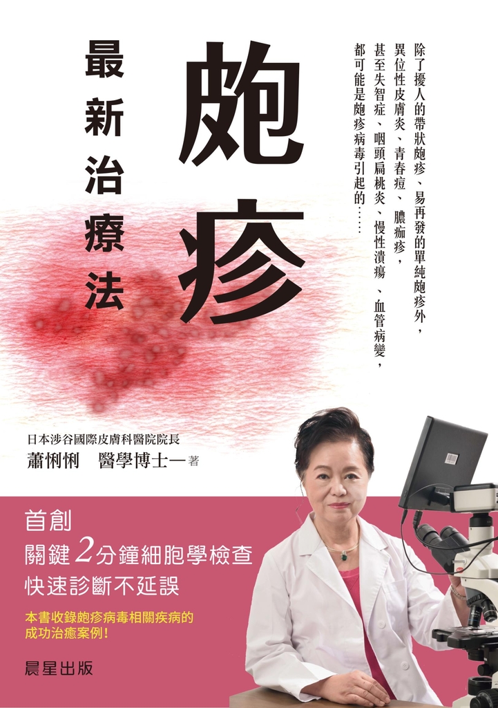 皰疹最新治療法